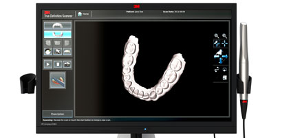 3M™ True Definition Scanner
