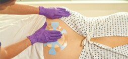 Considering the Connection Between Incontinence-Associated Dermatitis and Pressure Injuries article