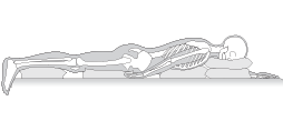 Pressure Injury Prevention for Prone Positioning article
